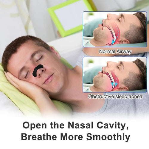 Anti-Snore Nose Strips